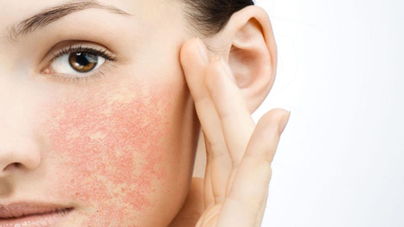 Bí quyết chăm sóc da nhạy cảm