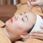 Hình ảnh cấp ẩm cho da dầu mụn